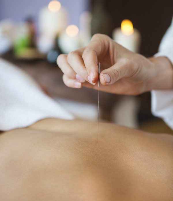 Close up of a hand placing acupuncture needle on back of a woman in salon